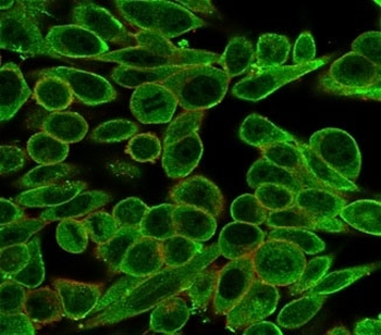 MED21 Antibody / SRB7