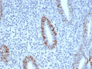 Recombinant CCNE1 Antibody / Cyclin E1