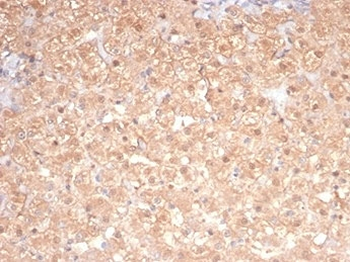 PKC iota Antibody / PRKCI