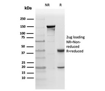 PKC iota Antibody / PRKCI