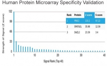 PKC iota Antibody / PRKCI