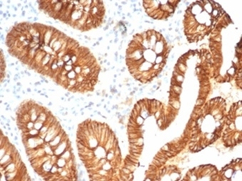 Recombinant CDH1 Antibody / E-Cadherin