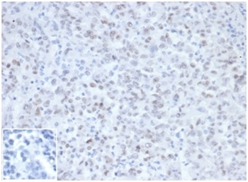 MLH1 Antibody / MutL Homolog 1