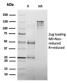 MLH1 Antibody / MutL Homolog 1