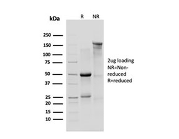 p120 Catenin Antibody / CTNND1 / Catenin delta 1