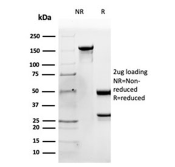 APOB Antibody / Apolipoprotein B