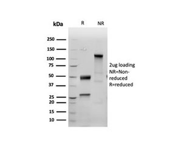 Recombinant INHA Antibody / Inhibin alpha