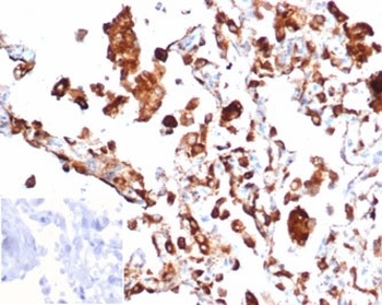 Recombinant Napsin A Antibody