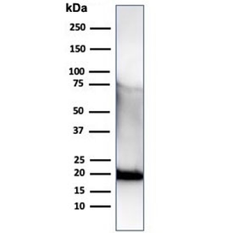 Recombinant His Tag Antibody / Histidine