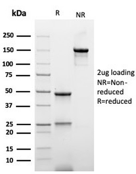 Recombinant His Tag Antibody / Histidine