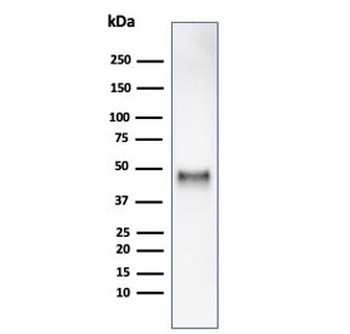 Recombinant Cyclin E1 Antibody / CCNE1