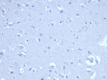 CD8A Antibody