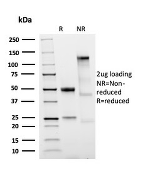 LMO2 Antibody / Rhombotin 2
