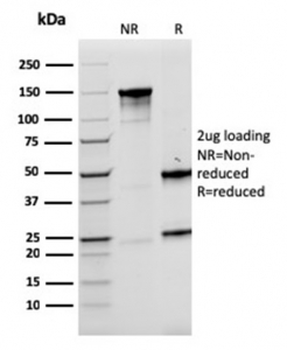 LMO2 Antibody / Rhombotin 2