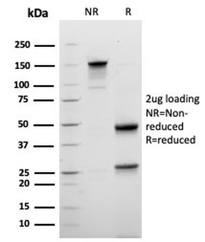 Mammaglobin A Antibody / SCGB2A2