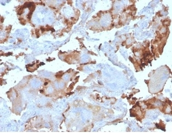 BPIFB1 Antibody / LPLUNC1