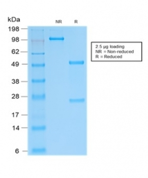 Recombinant SOX9 Antibody