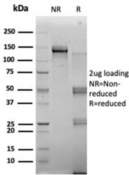 RBMS2 Antibody / SCR3