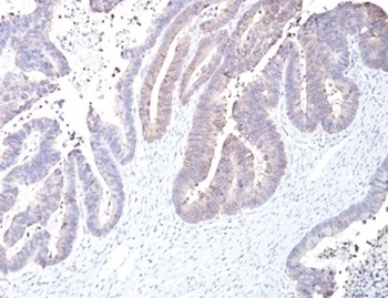 COX2 Antibody / PTGS2