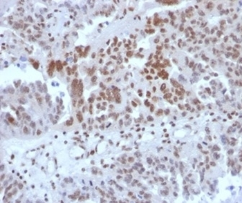 SP100 Antibody