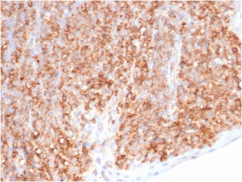 HLA-G Antibody