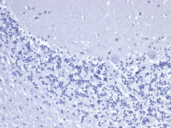 KRT8 Antibody / Cytokeratin 8