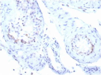 Recombinant StAR Antibody / Steroidogenic acute regulatory protein