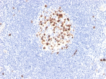 Recombinant Topoisomerase II alpha Antibody / TOP2A