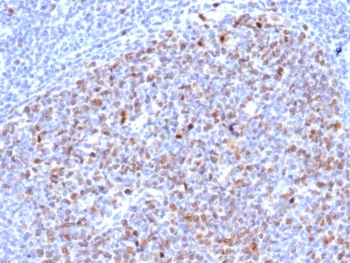 Recombinant Topoisomerase II alpha Antibody / TOP2A