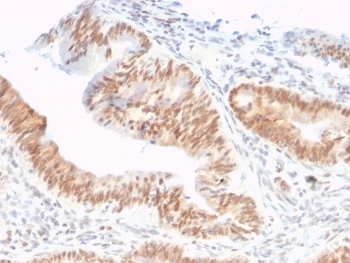 CSTF2T Antibody / Cleavage stimulation factor subunit 2 tau variant