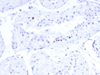 CSTF2T Antibody / Cleavage stimulation factor subunit 2 tau variant