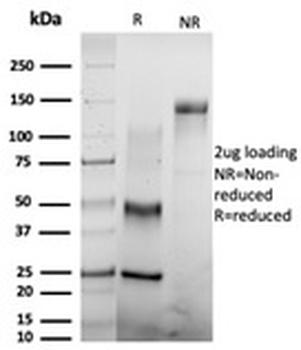 CSTF2T Antibody / Cleavage stimulation factor subunit 2 tau variant