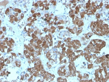 ACTH Antibody / CLIP