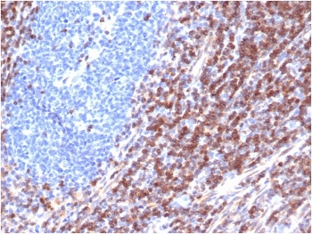Recombinant Bcl-2 Antibody