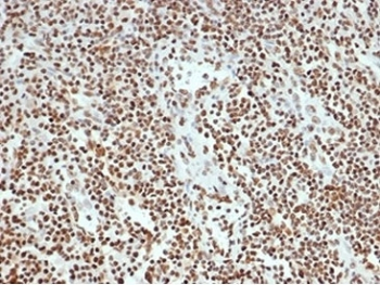 Ku80 Antibody / XRCC5