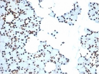 Ku80 Antibody / XRCC5