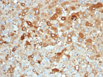 Albumin Antibody