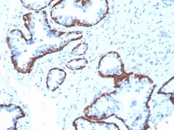 Cytokeratin 5 Antibody / KRT5