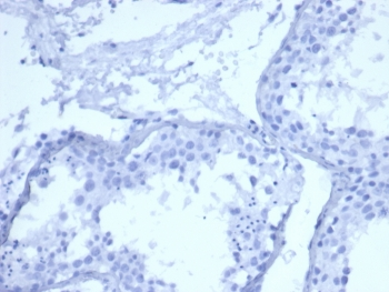 Cytokeratin 5 Antibody / KRT5