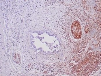 Recombinant SMAD4 Antibody
