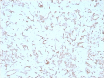 Kindlin 2 Antibody / KIND2