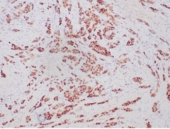 Recombinant Progesterone Receptor Antibody