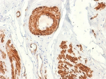 Recombinant Caldesmon Antibody / CAD / CALD1 (HMW)