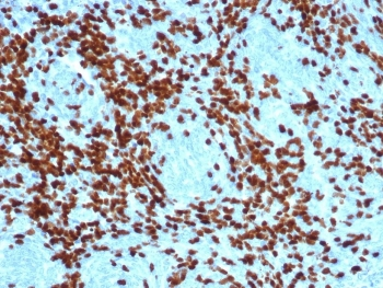 TdT Antibody / DNA nucleotidylexotransferase