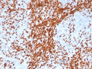 TdT Antibody / DNA nucleotidylexotransferase
