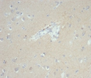Recombinant EpCAM Antibody / Cytoplasmic domain