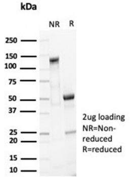 EpCAM Antibody / Cytoplasmic domain