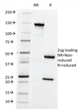 HLA-ABC Antibody (MHC I)
