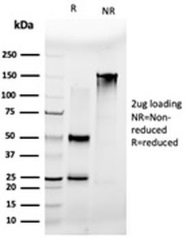 MLX Antibody / Max-like protein X