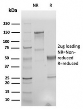 Recombinant Human Nuclear Antigen Antibody